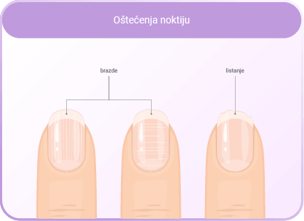 Jačanje noktiju